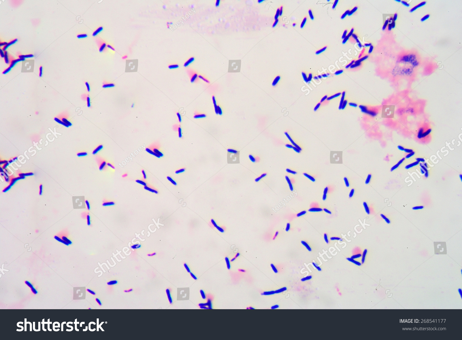 Gram Stian Show Gram Positive Bacilli Stock Photo 268541177 | Shutterstock