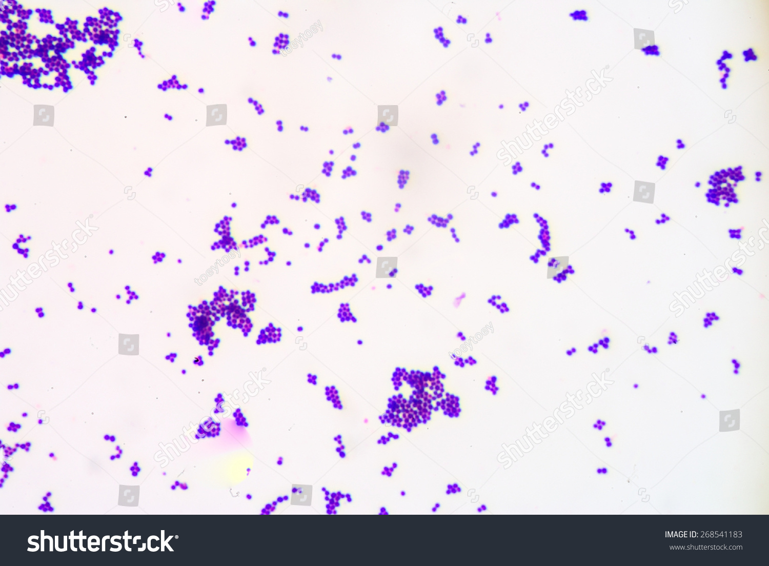 Gram Staininggram Positive Cocci Stock Photo 268541183 | Shutterstock