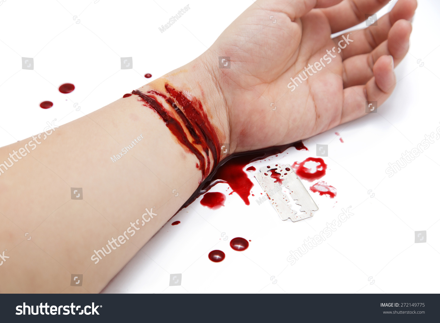 Стоковая фотография 272149775: Hand Full Blood Wrist Cut By Shutterstock.
