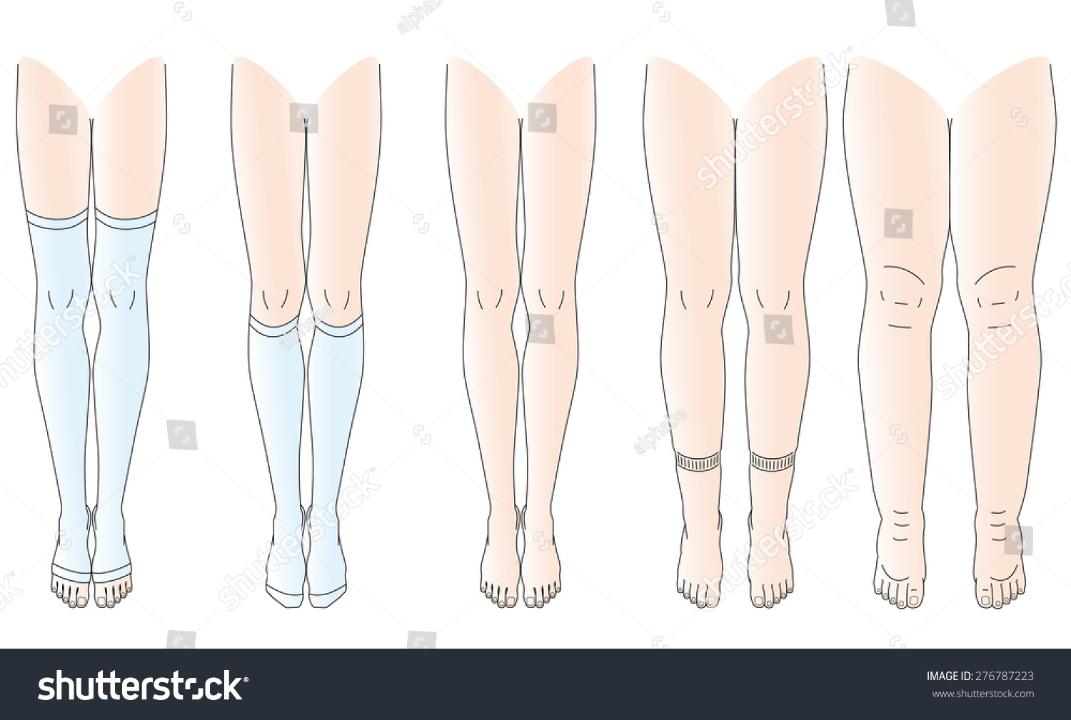 Legs There Edema No Swelling Legs Stock Vector (Royalty Free) 276787223 ...