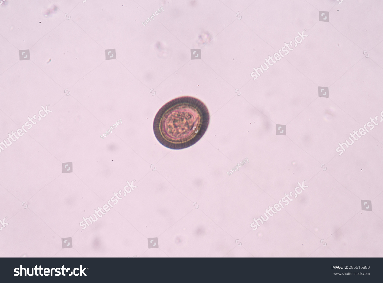 Taenia Genus Tapeworm Type Helminth That Stock Photo 286615880 ...