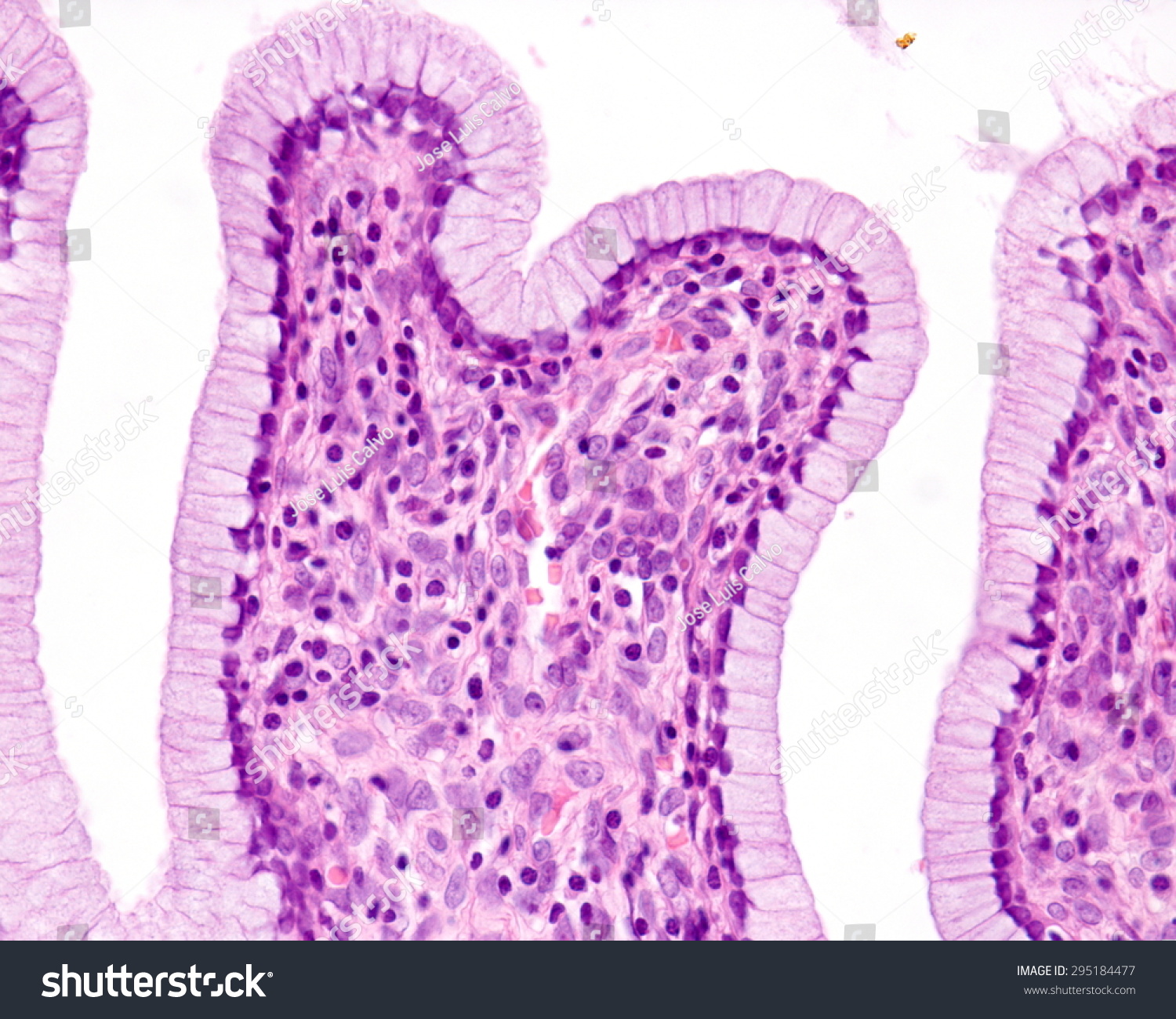 Simple Columnar Epithelium Uterine Cervix Epithelium 스톡 사진 295184477 ...