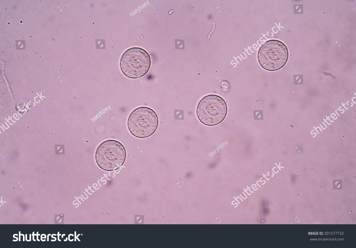 Повышенный эпителий в моче у мужчин. Почечный эпителий в моче микроскопия. Клетки плоского эпителия в моче под микроскопом. Почечный эпителий в осадке мочи под микроскопом. Микроскопия осадка мочи эпителий.