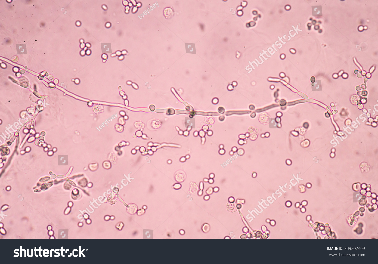 Budding Yeast Cells Pseudohyphae Urine Sample Stock Photo Shutterstock