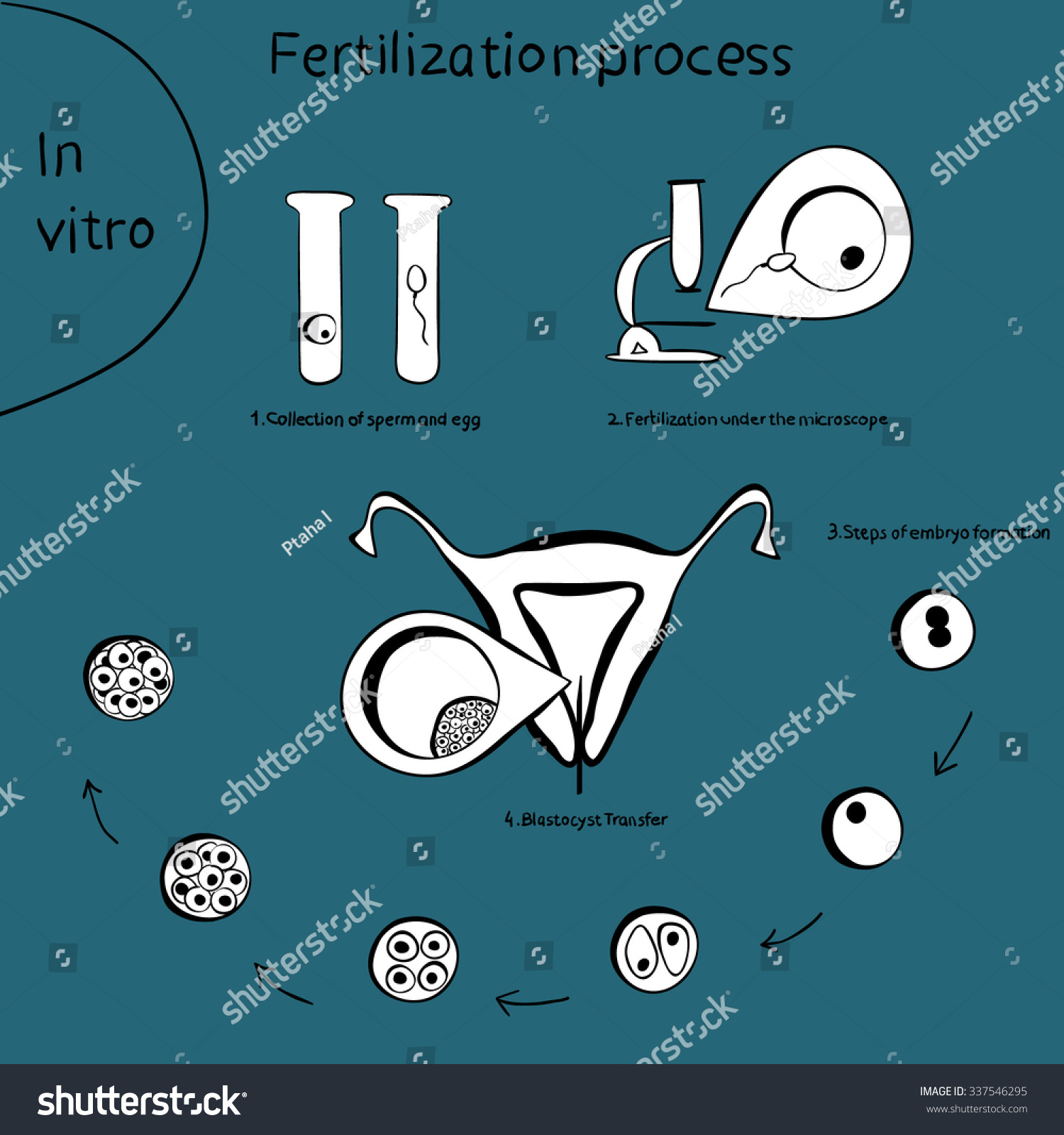 Vitro Fertilization Infographics Process Icons Stages Stock Vector Royalty Free 337546295