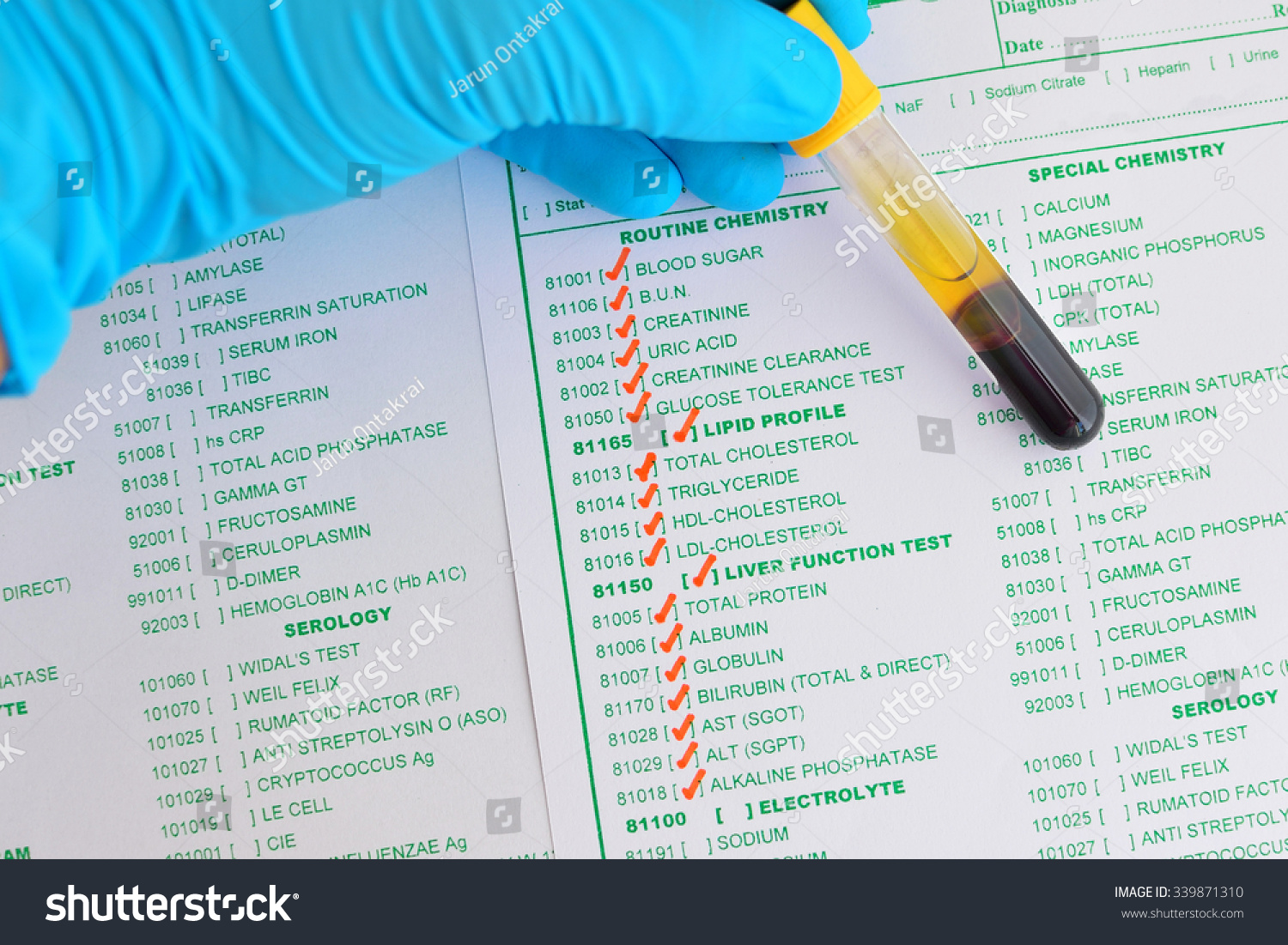 Blood Sample Routine Chemistry Testing Stock Photo 339871310 | Shutterstock