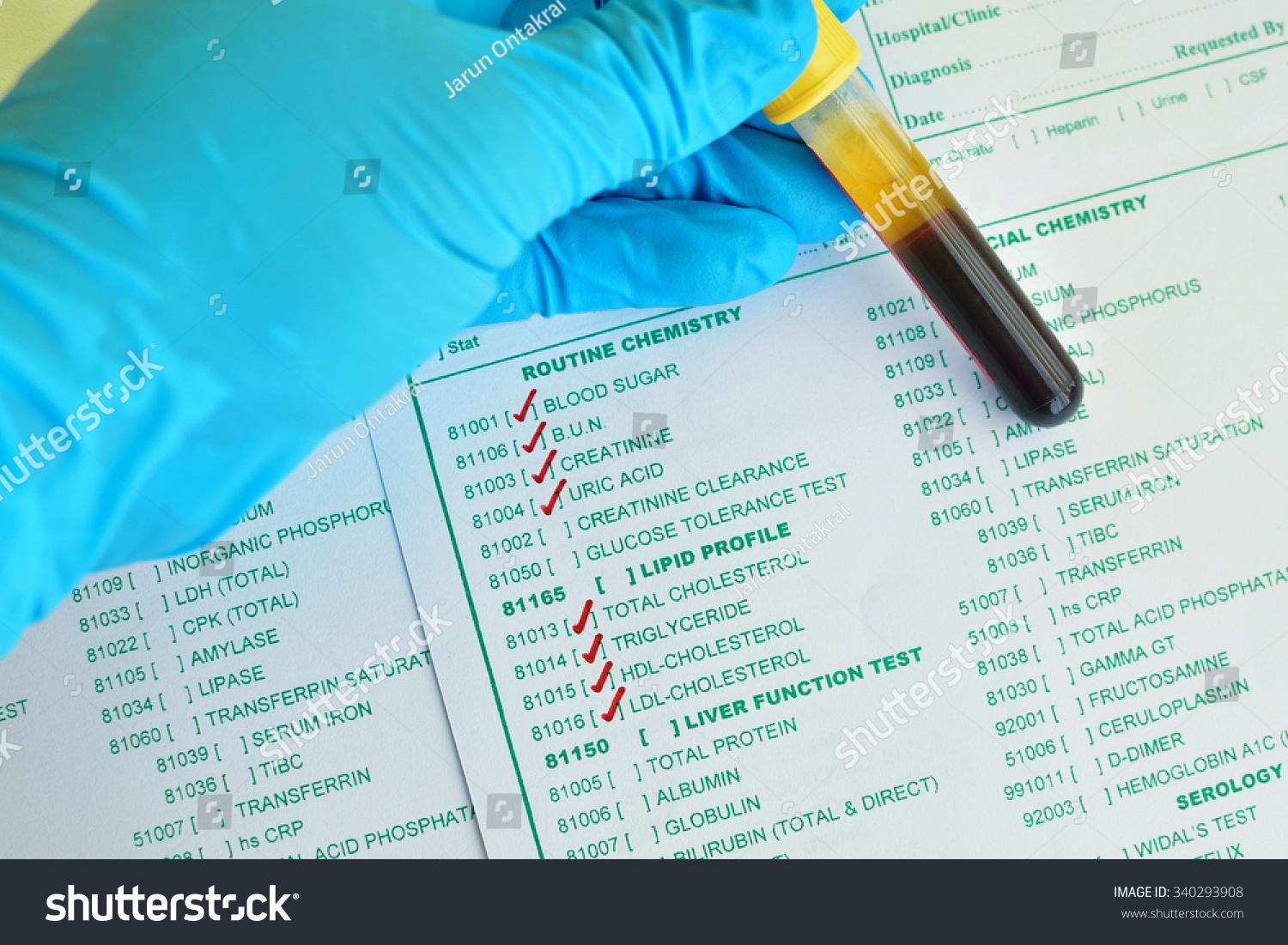 Blood Sample Routine Chemistry Testing Stock Photo 340293908 | Shutterstock