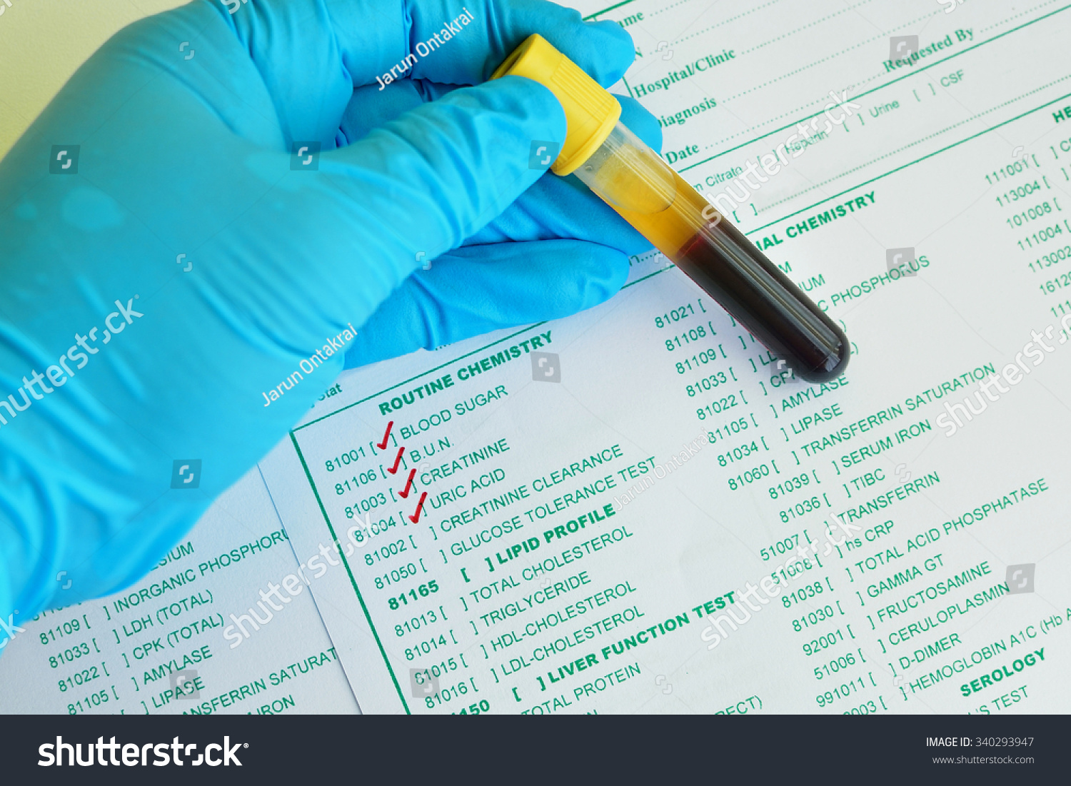 Blood Sample Routine Chemistry Testing Stock Photo 340293947 | Shutterstock