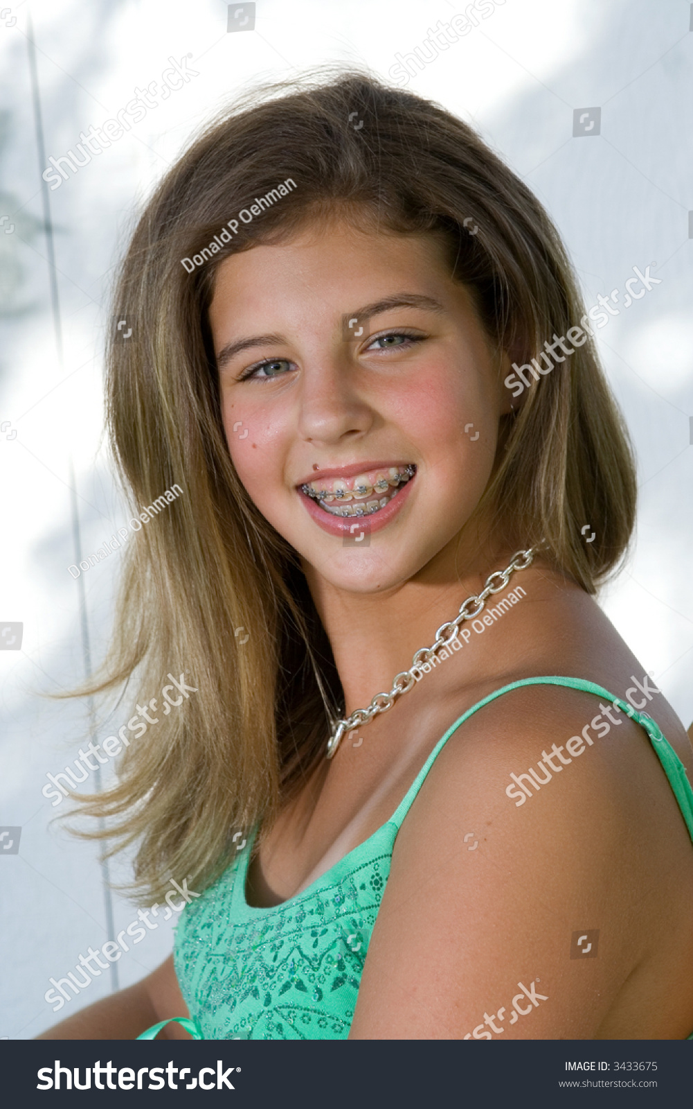 Teen Girls With Braces