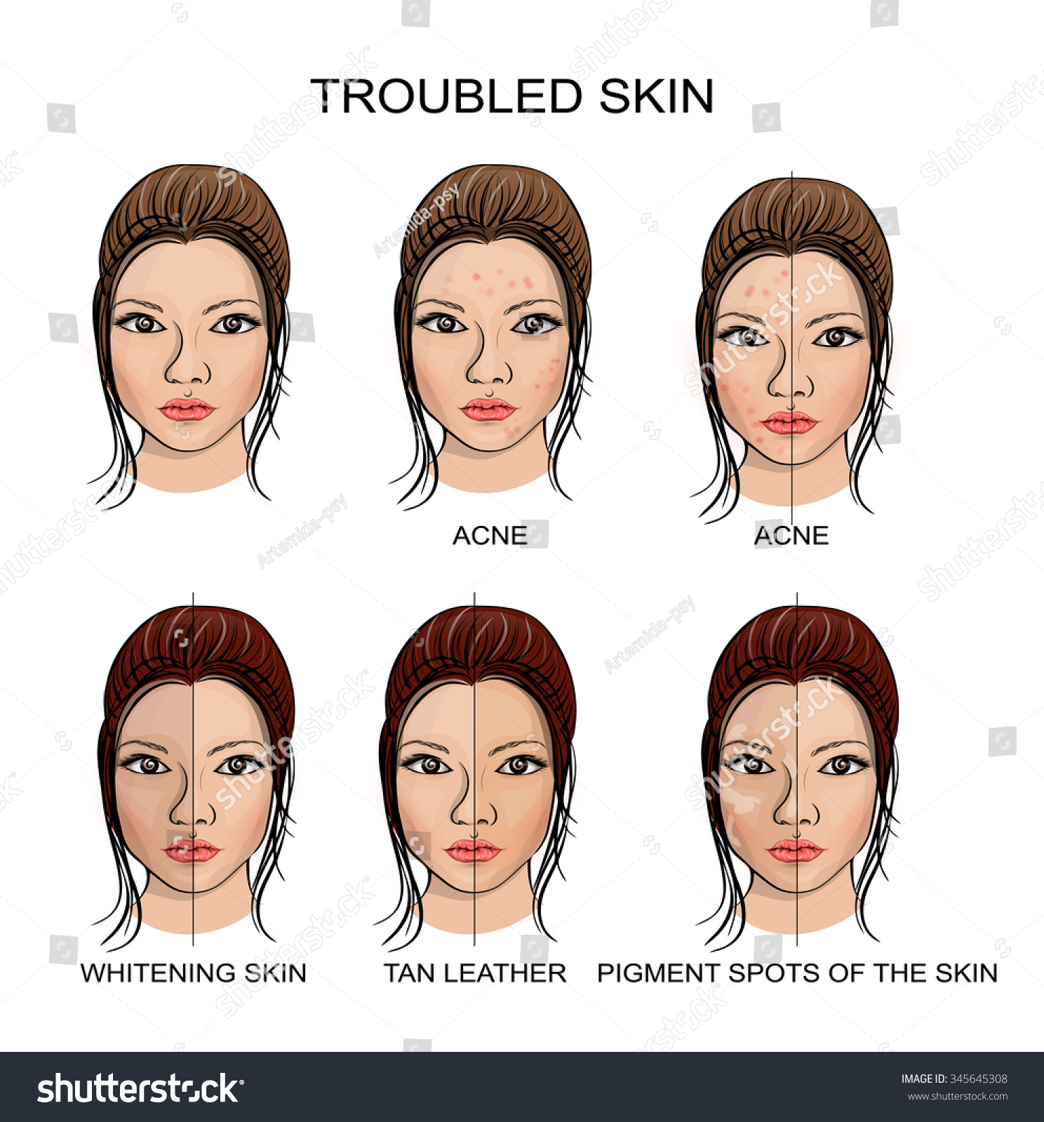 Illustration Healthy Problematic Skin Stock Vector (Royalty Free ...