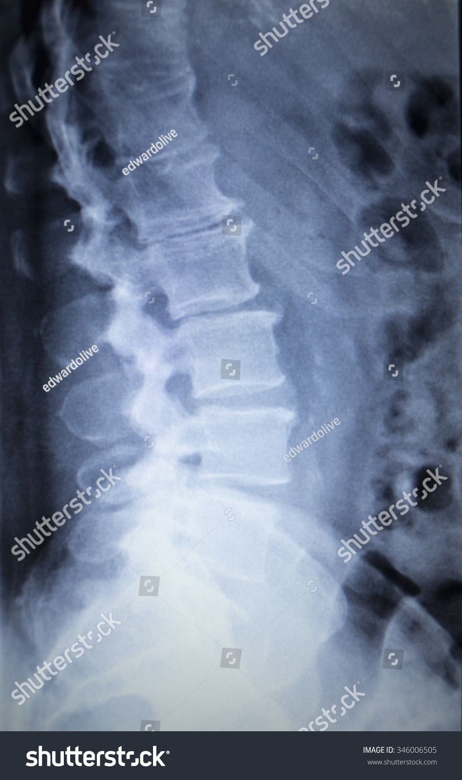 241 Lower Back Scan Images, Stock Photos & Vectors | Shutterstock