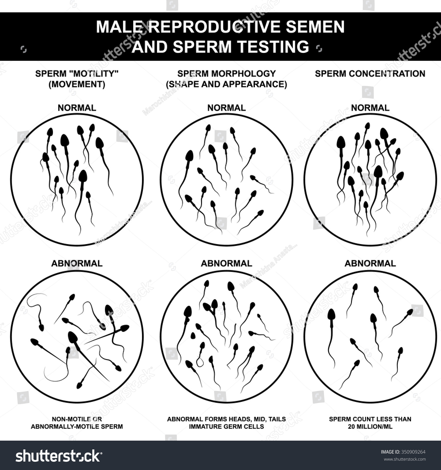 сколько сперматозоидов при оргазме фото 24