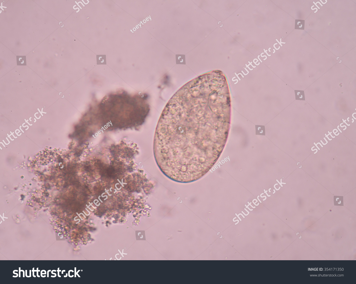 Egg Parasite Stool Exam Stock Photo 354171350 | Shutterstock