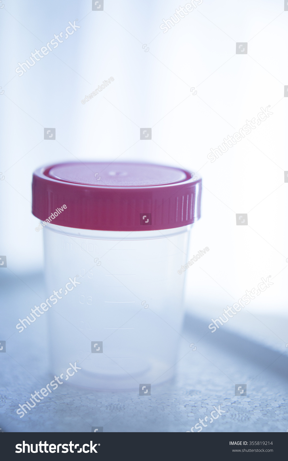 Urine Sample Plastic Beaker Urine Testing Stock Photo 355819214 ...