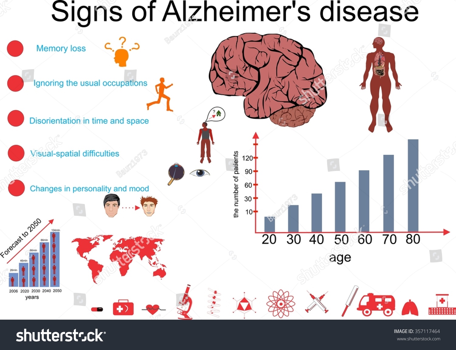 Alzheimers Disease Infographic Vector Illustration Stock Vector Royalty Free