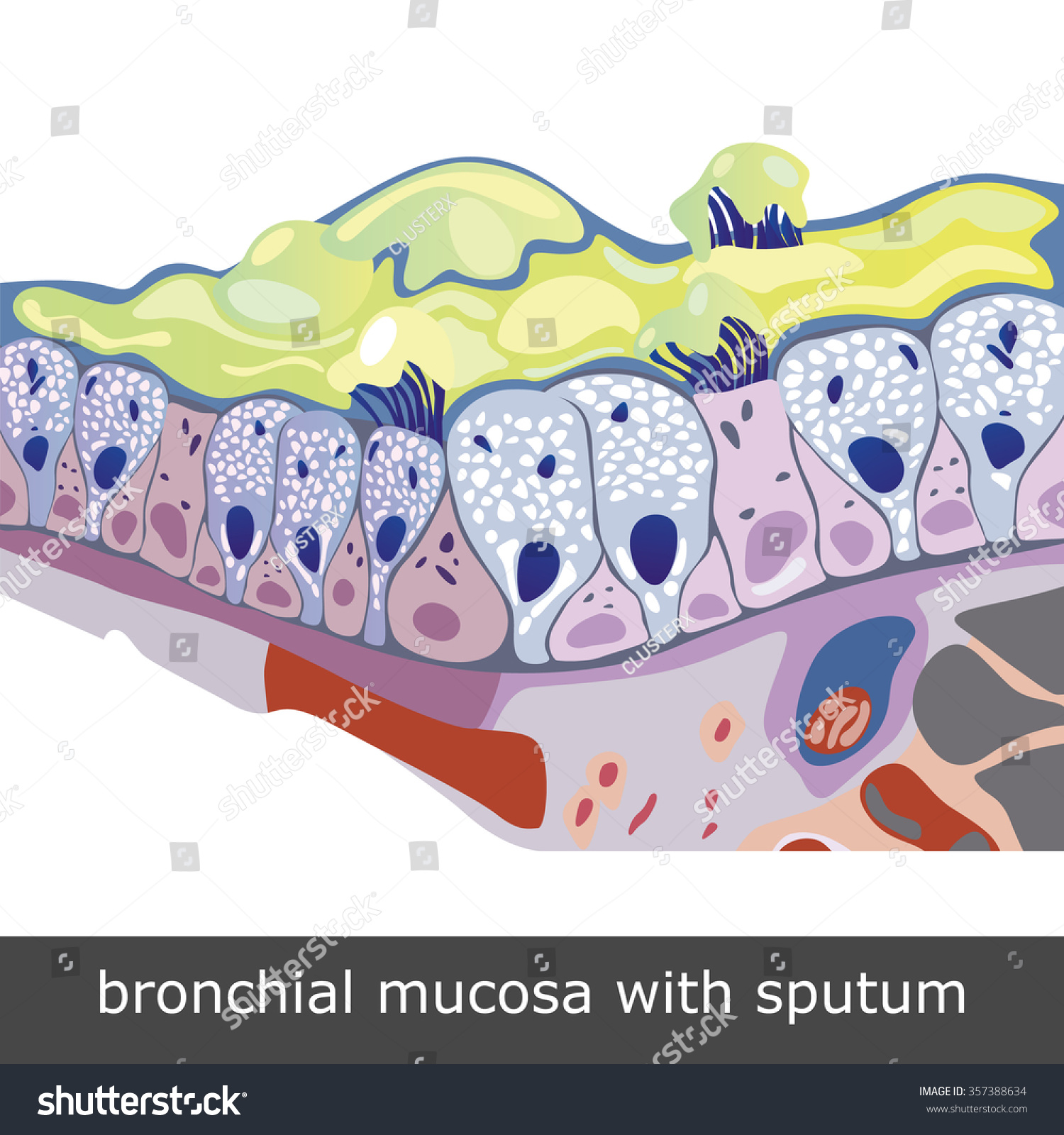 Structure Damaged Bronchial Mucosa Sputum Vector Stock Vector (Royalty ...