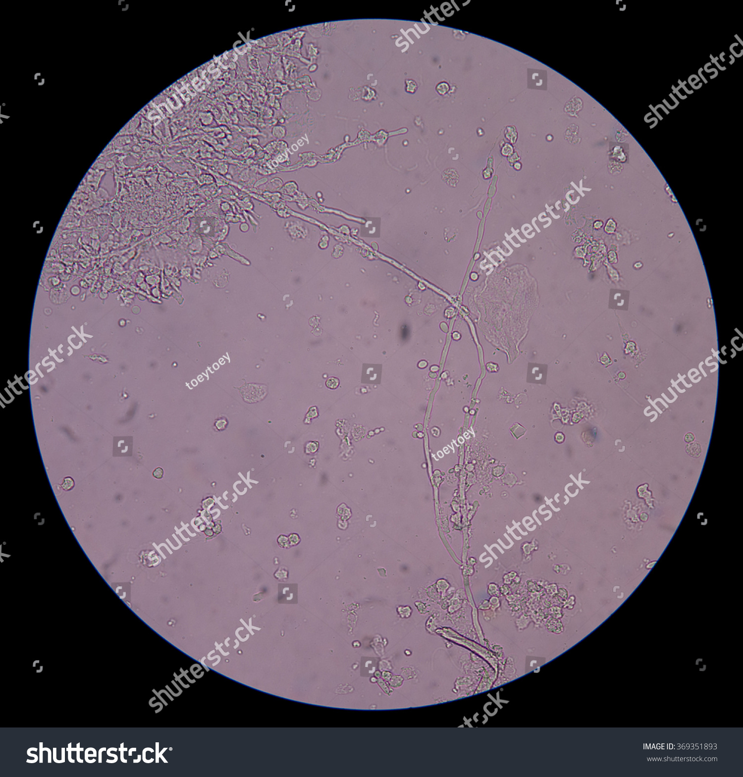 Fresh Branching Budding Yeast Cells Pseudohyphae Stock Photo 369351893 ...