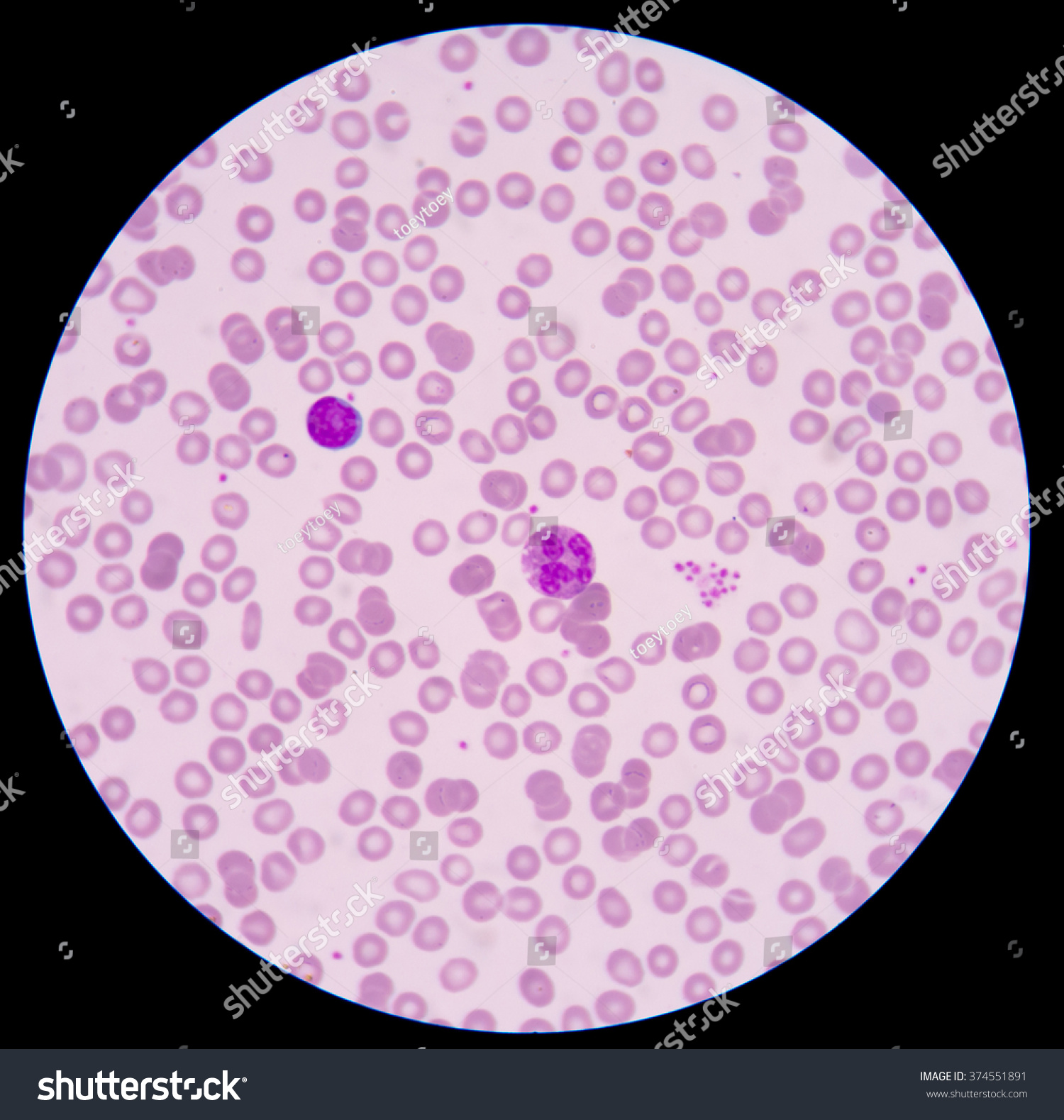 Blood Smear Often Used Followup Test Stock Photo 374551891 | Shutterstock