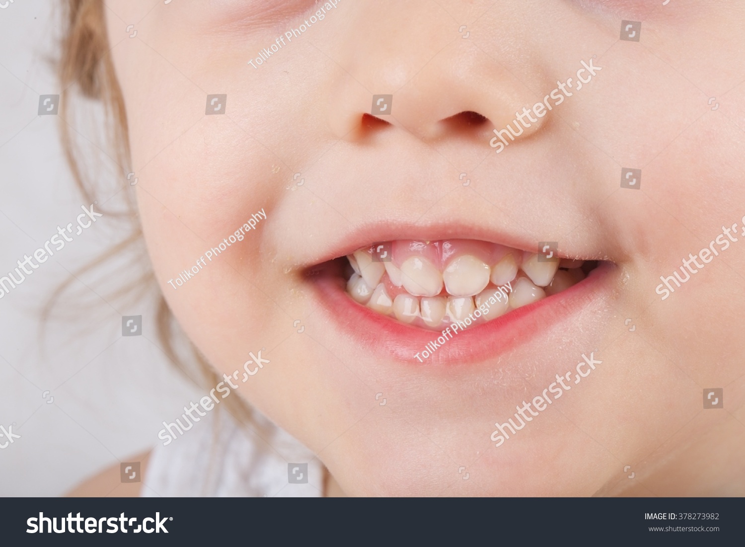 Детские зубы в три года