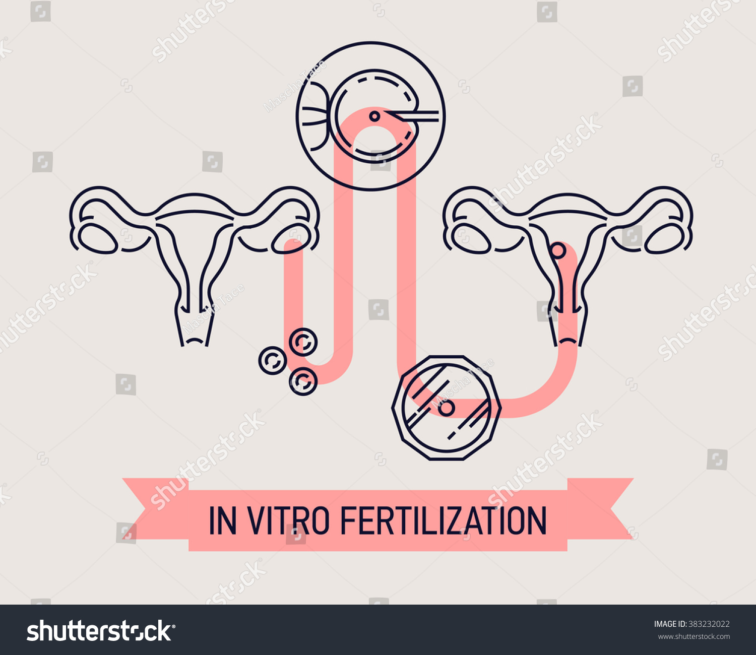 Flat Line Vitro Fertilization Diagram Vector Stock Vector Royalty Free 383232022 Shutterstock 0468