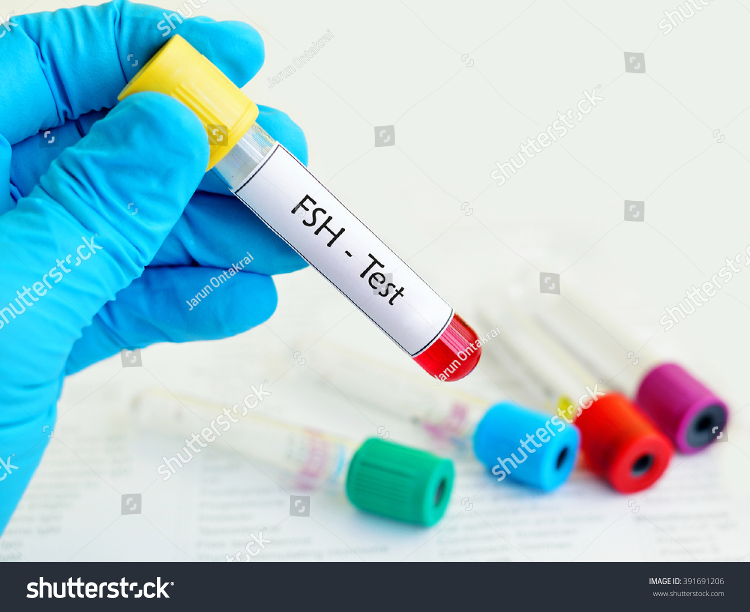 Test Tube Blood Sample Follicle Stimulating Stock Photo 391691206 