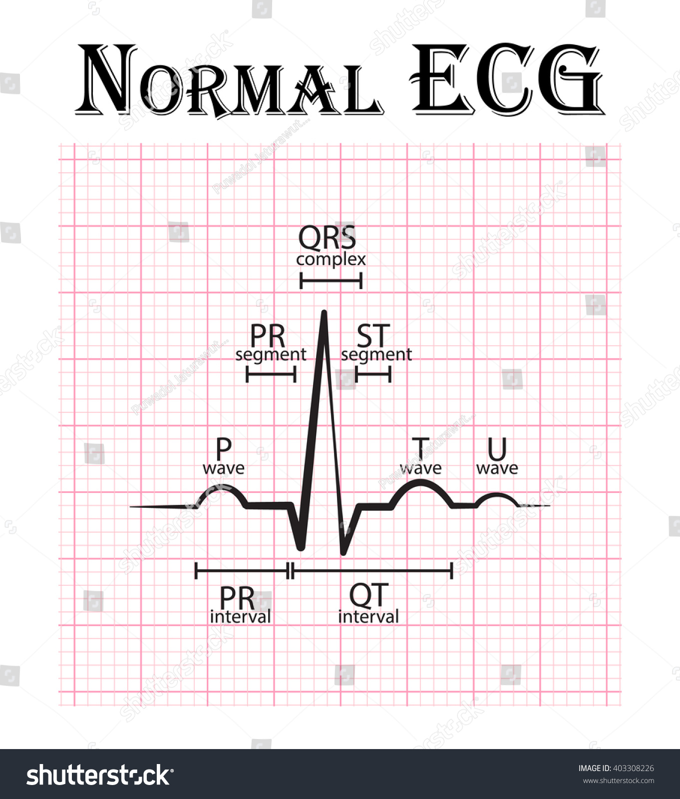 vektor-stok-ekg-normal-elektrokardiogram-gelombang-p-segmen-tanpa