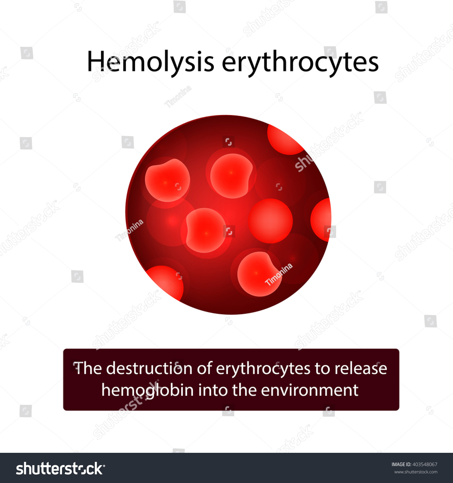 Erythrocytes Hemolysis Red Blood Cells Vector Stock Vector (Royalty ...