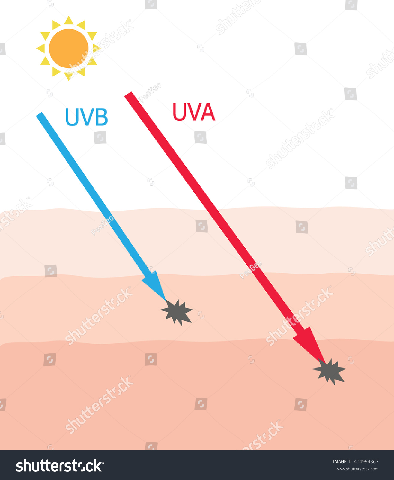 Skin Damaged By Uva Uvb Ray Stock Vector (royalty Free) 404994367 