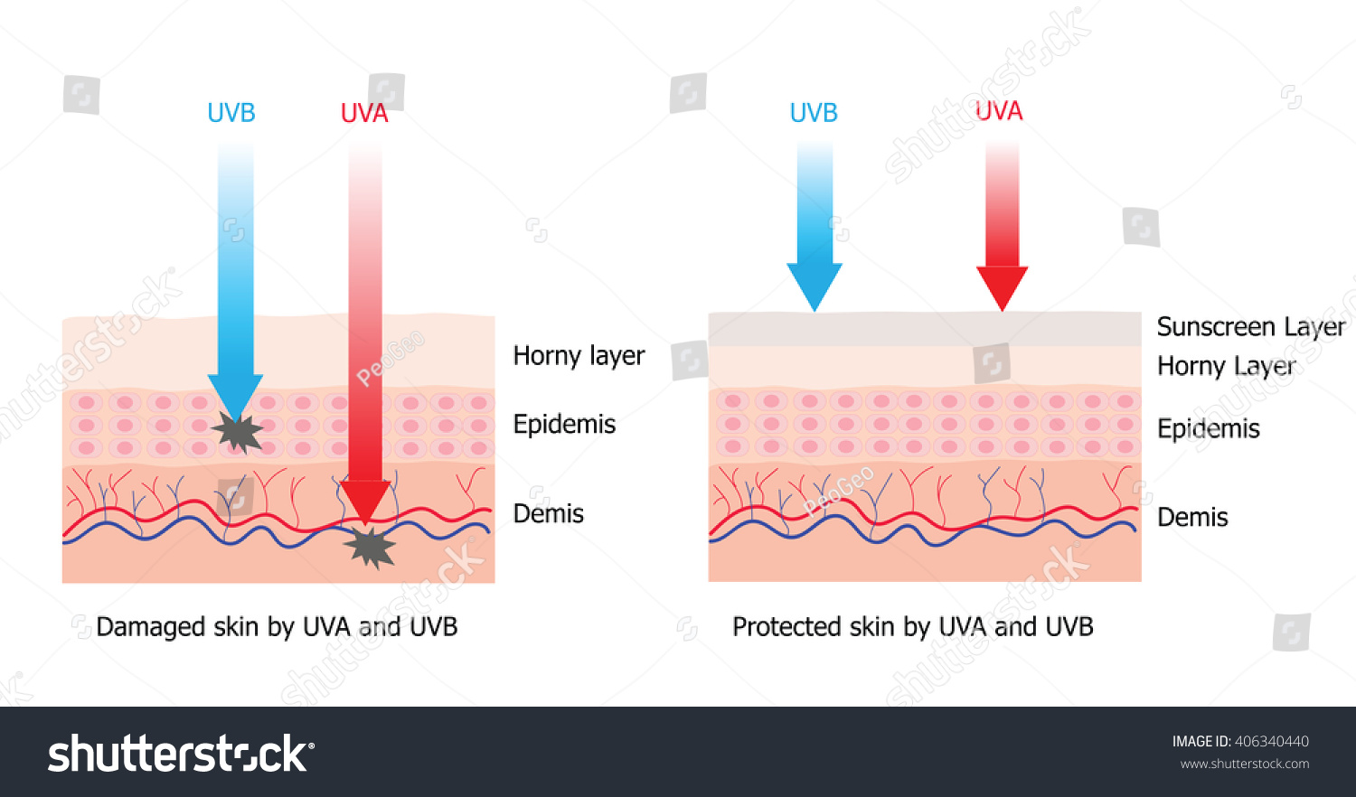 Skin Compare Between Skin Spectrumboarding Sunscreen Stock Vector ...