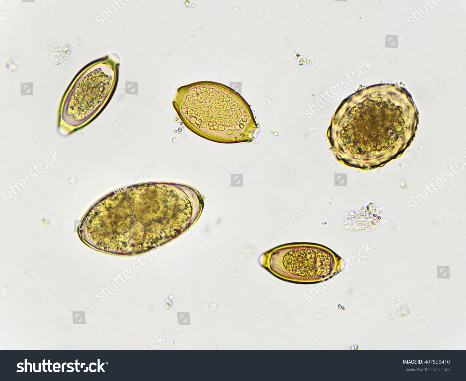 Простейшие в кале лечение. Микроскопия кала яйца гельминтов. Яйца гельминтов и энтеробиоз. Яйца острицы яйца аскариды.