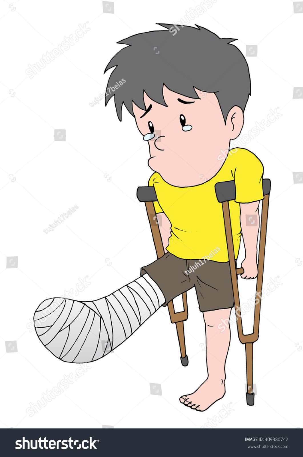 Illustration Man Broken Leg Stock Vector (Royalty Free) 409380742 ...