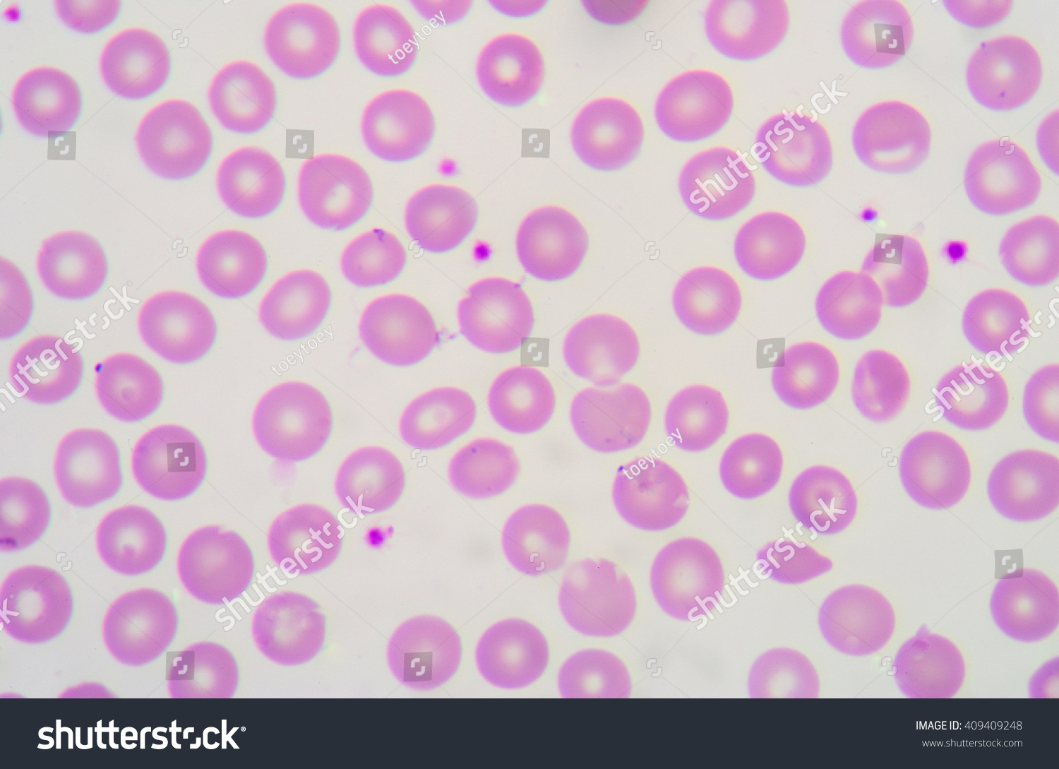 normal-red-blood-cells-morphology-stock-photo-409409248-shutterstock