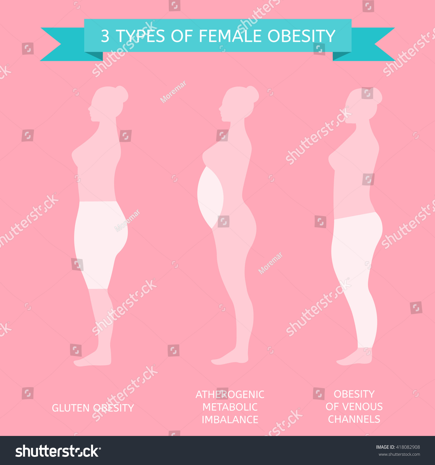 3 Types Obesity Female Figure Profile Stock Vector (Royalty Free ...