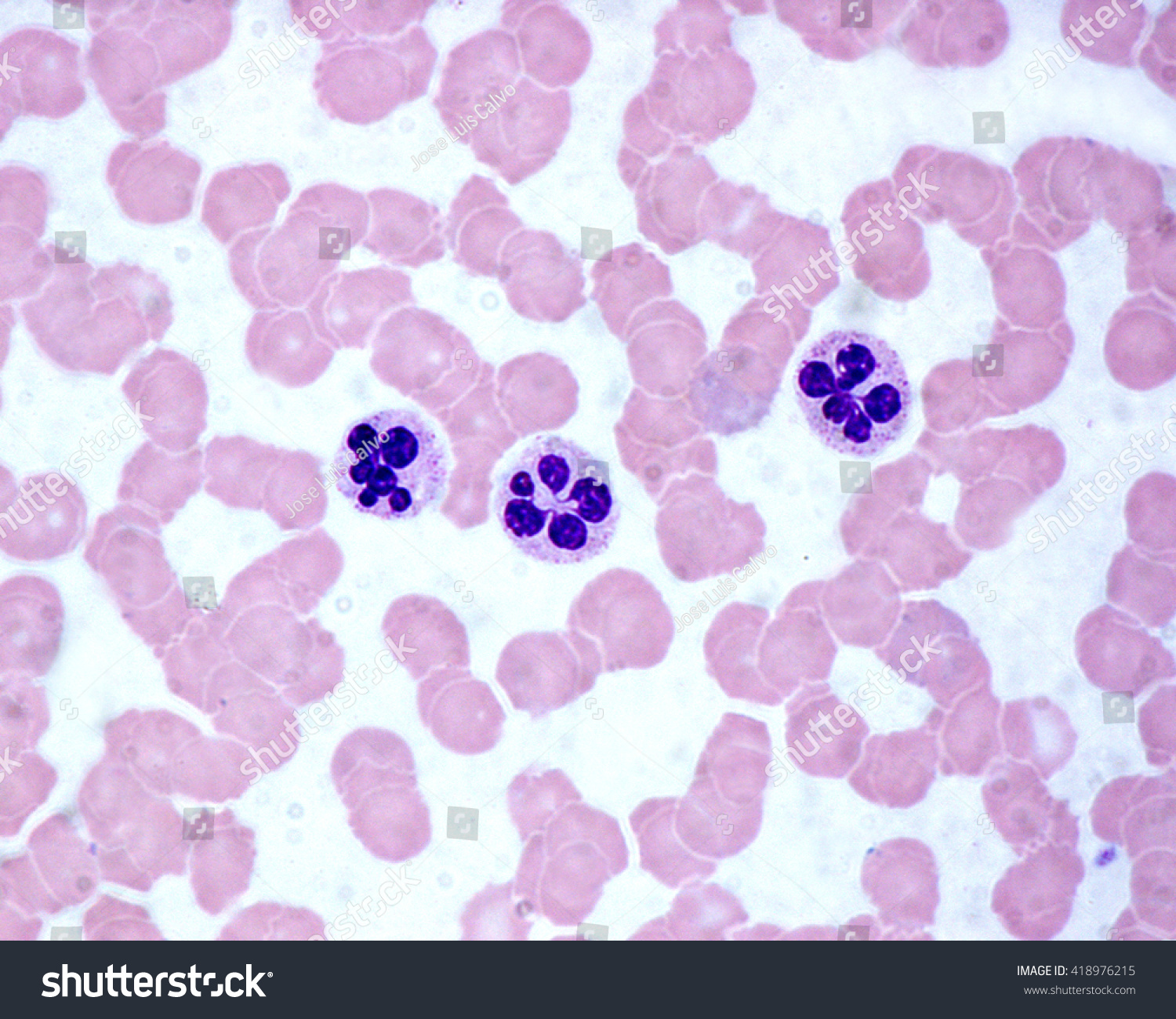 Blood Smear Showing Center Three Neutrophil Stock Photo 418976215 