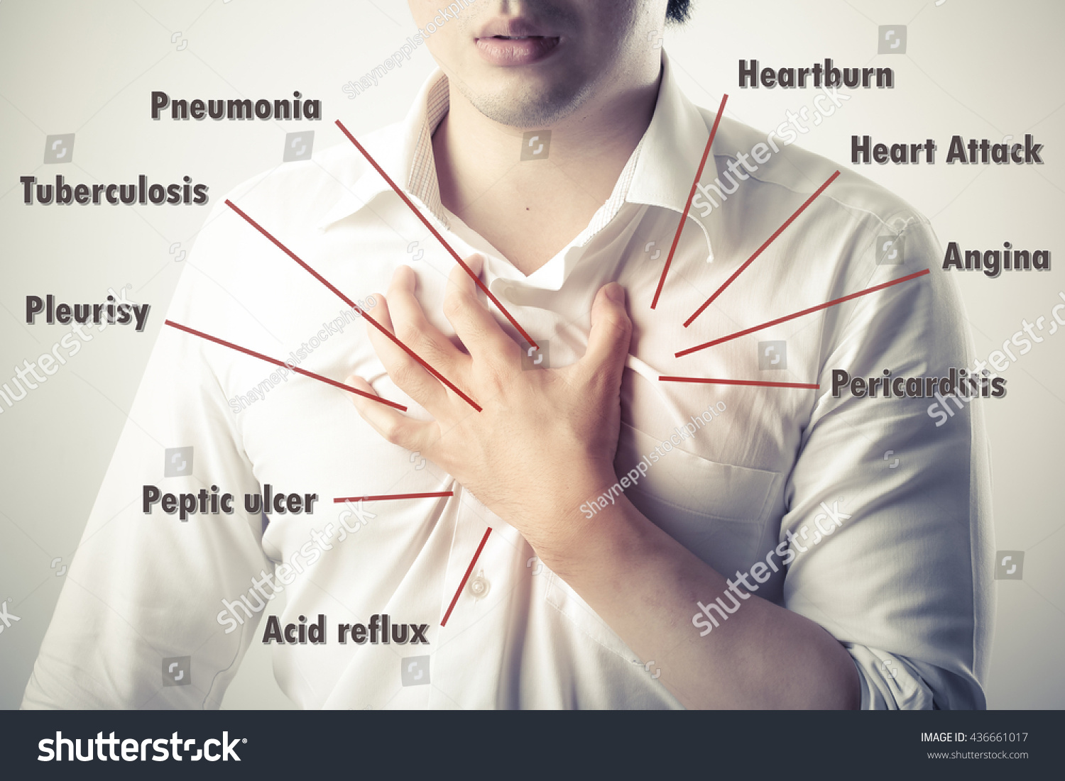 chest-pain-causes-disease-diagram-436661017-shutterstock