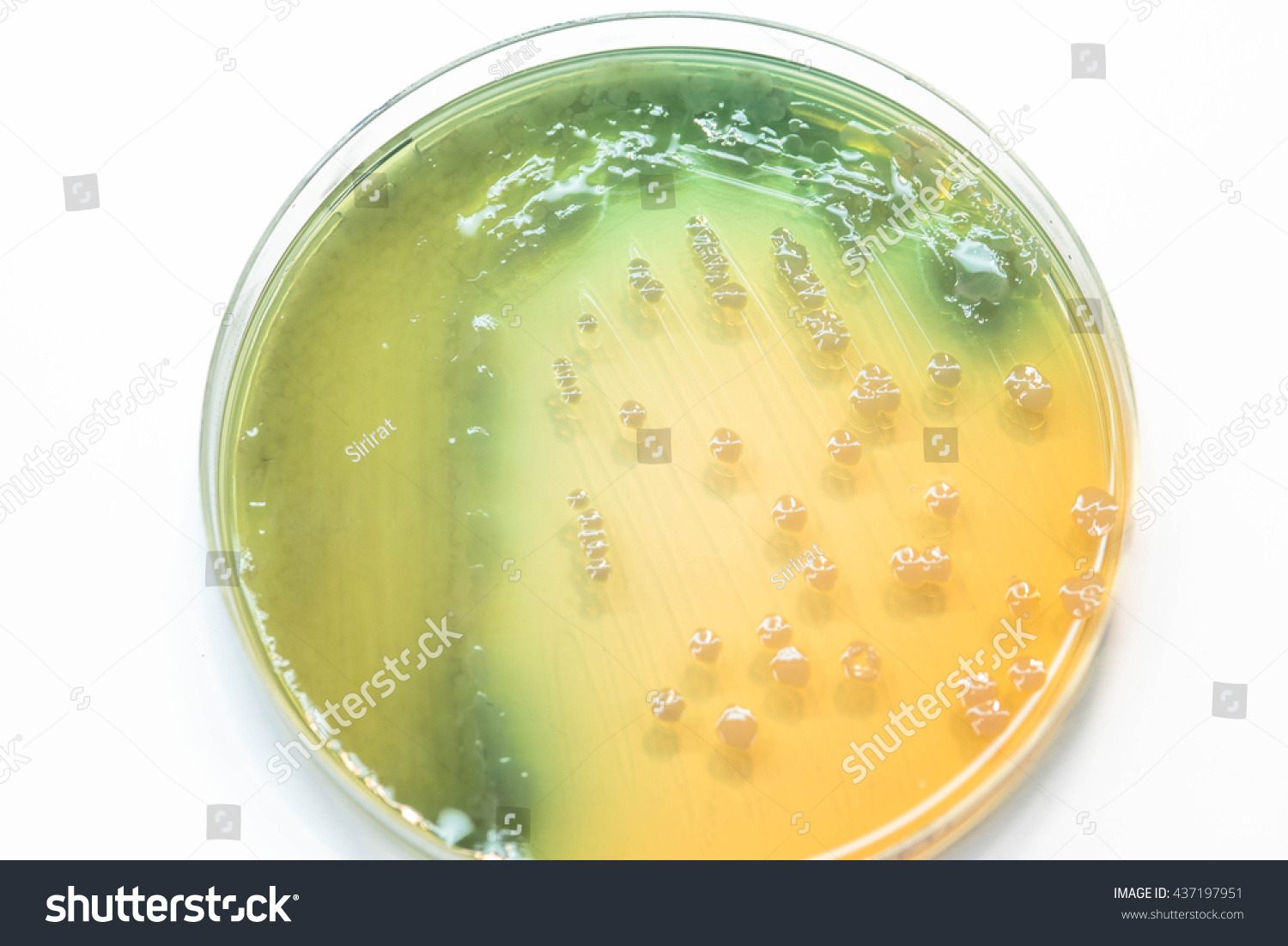 Bacteria Culture Growth On Agar Plate Stock Photo 437197951 | Shutterstock