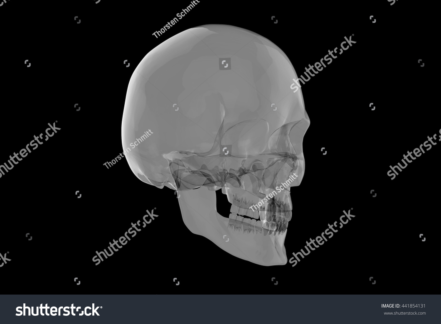 Xray Human Skull 3d Rendering Stock Illustration 441854131 | Shutterstock