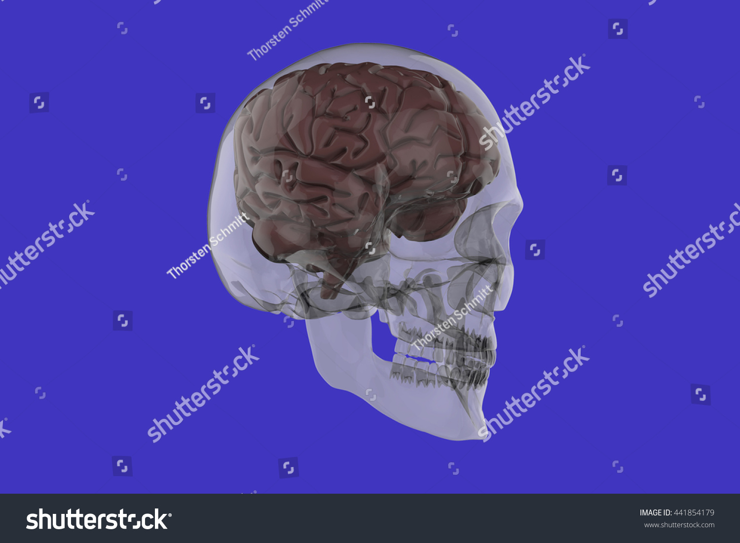 Xray Human Skull 3d Rendering Stock Illustration 441854179 | Shutterstock