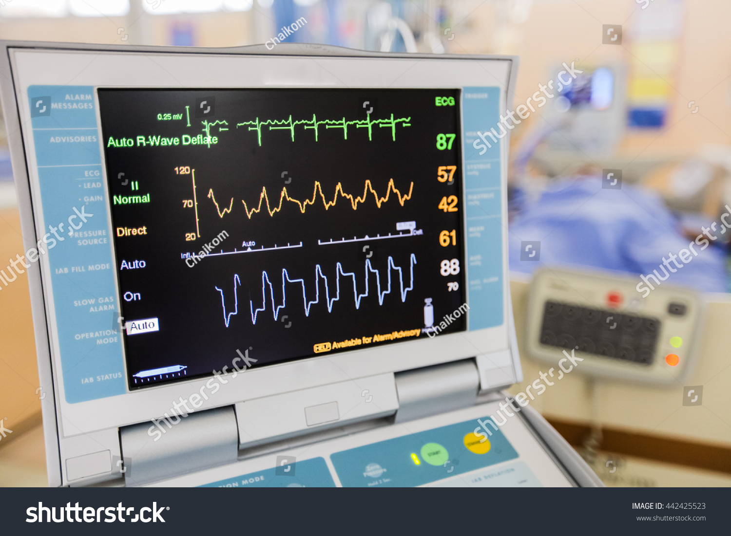 Vital Signs Monitor Hospital Stock Photo 442425523 | Shutterstock