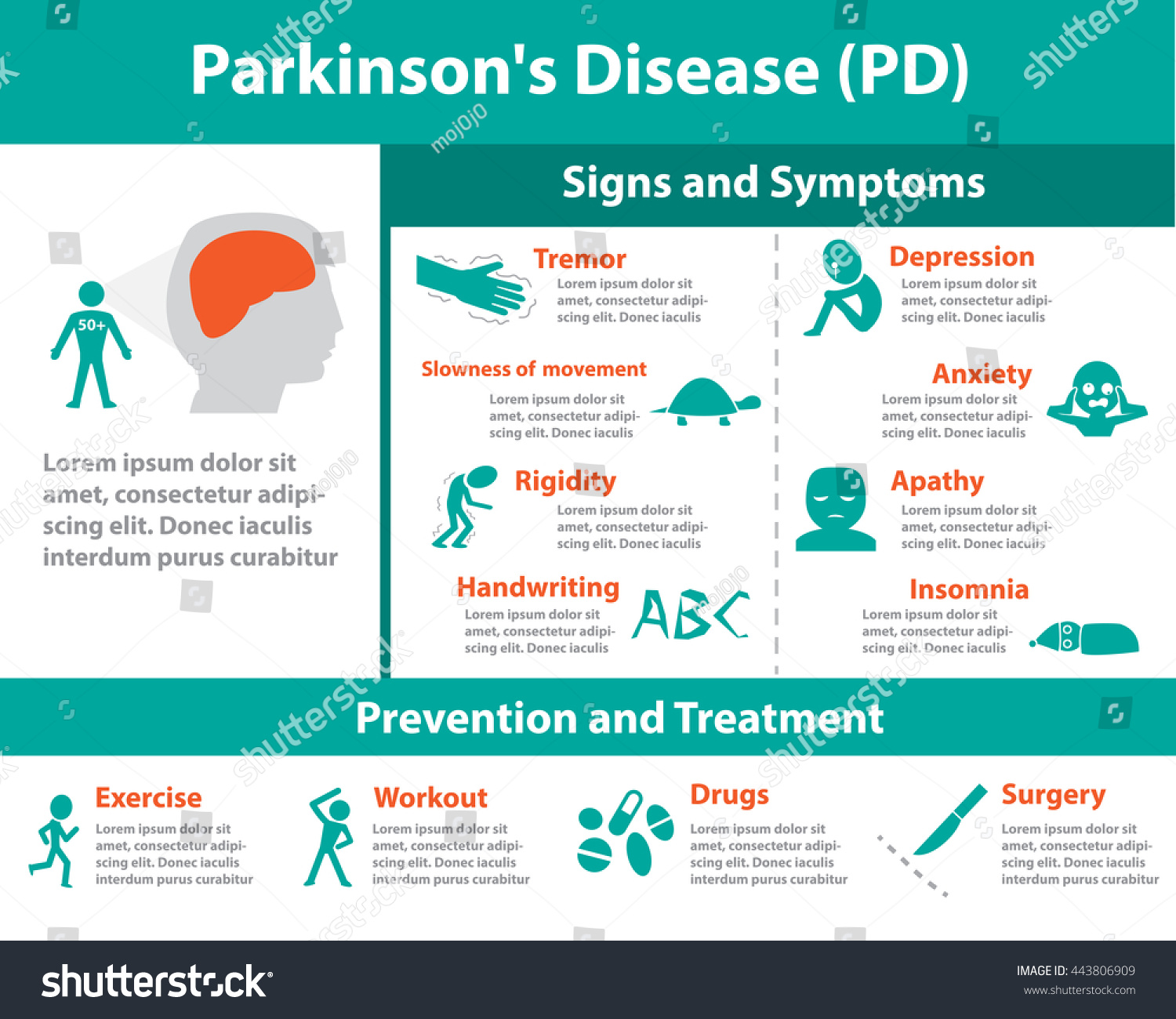 Vektor Stok Parkinsons Disease Infographic Monochrome Tanpa Royalti 443806909 Shutterstock