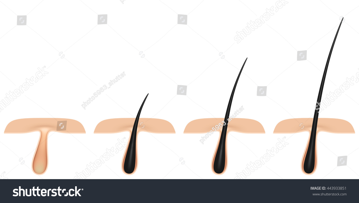 Hair Follicle Cross Section 3d Illustration Stock Illustration ...