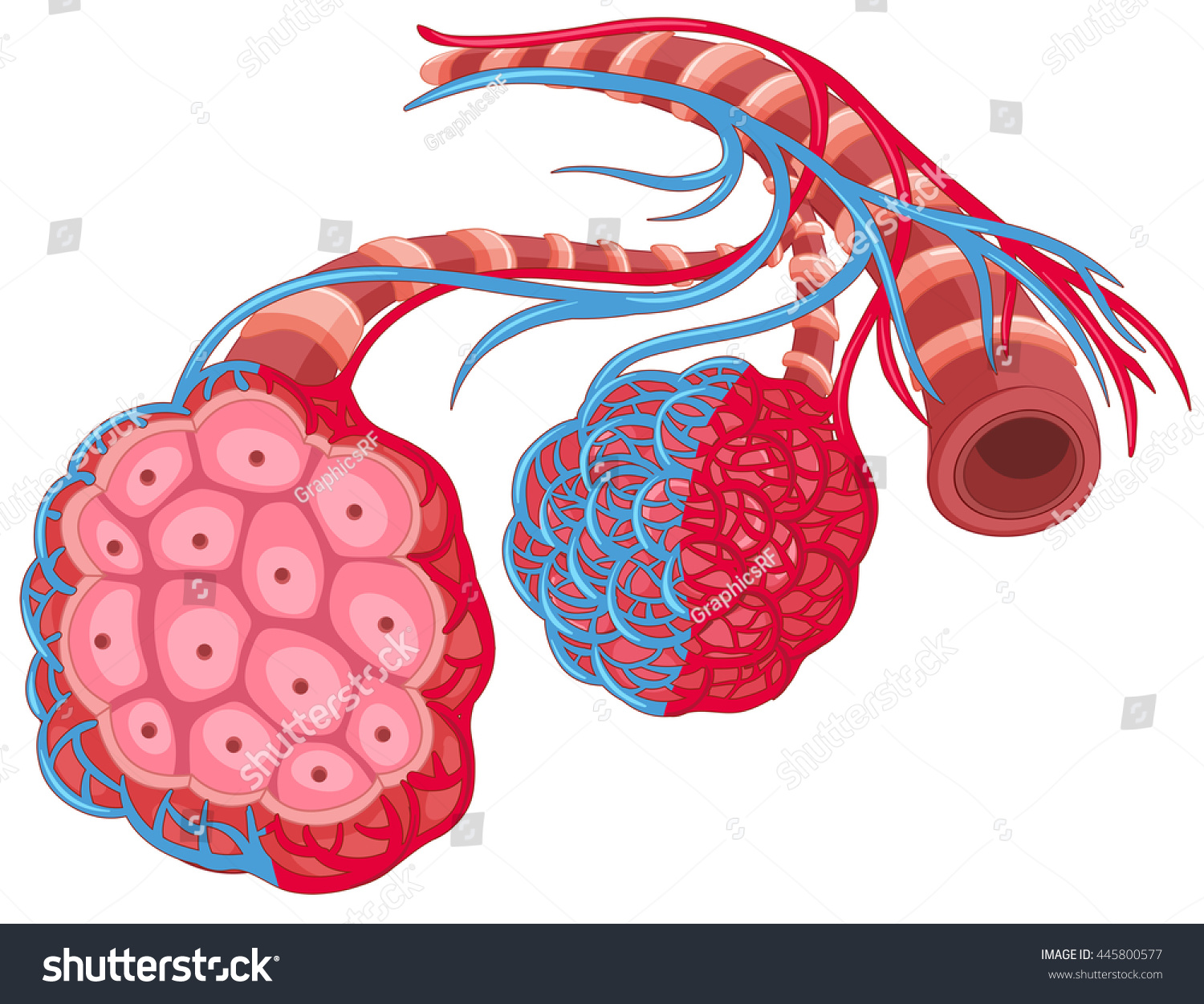 Human Lung Disease Illustration Stock Vector (Royalty Free) 445800577 ...