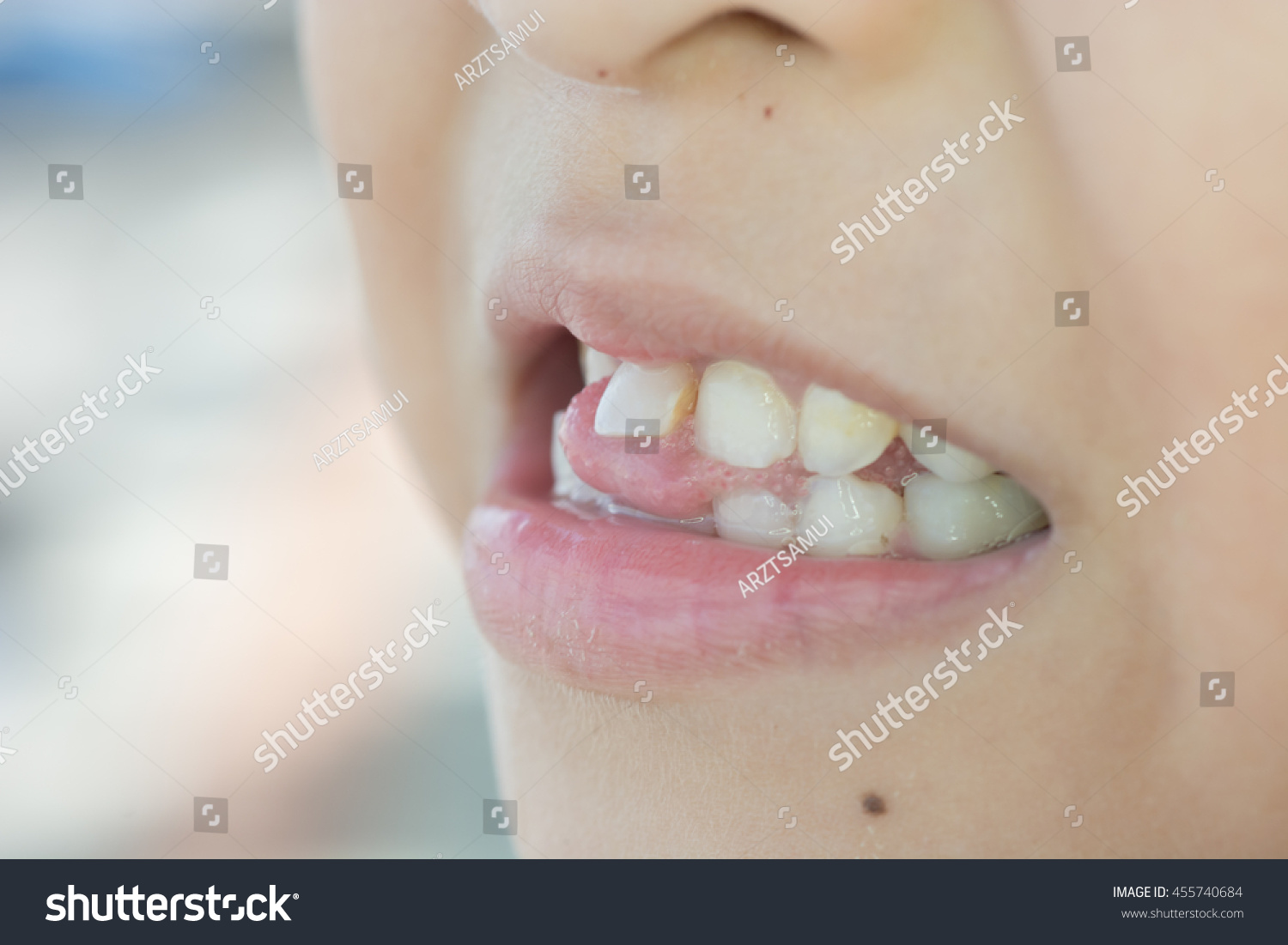 child skull milk teeth