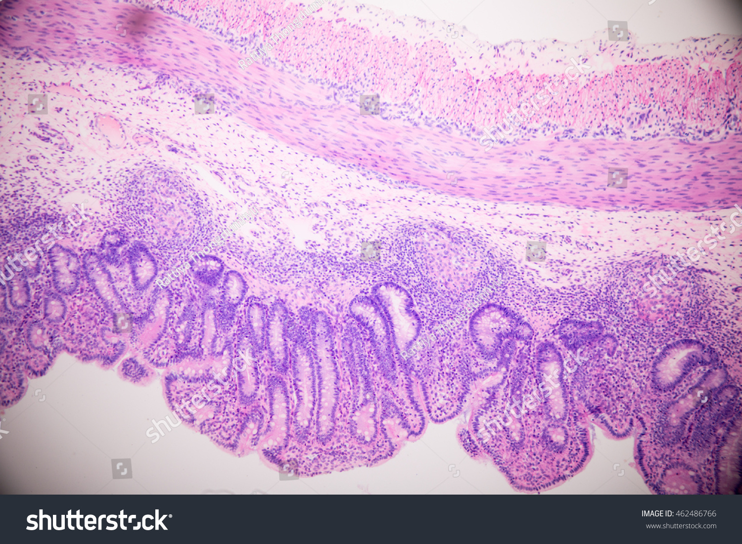 Cross Section Stomach Tissue Microscopic View Stock Photo 462486766 ...