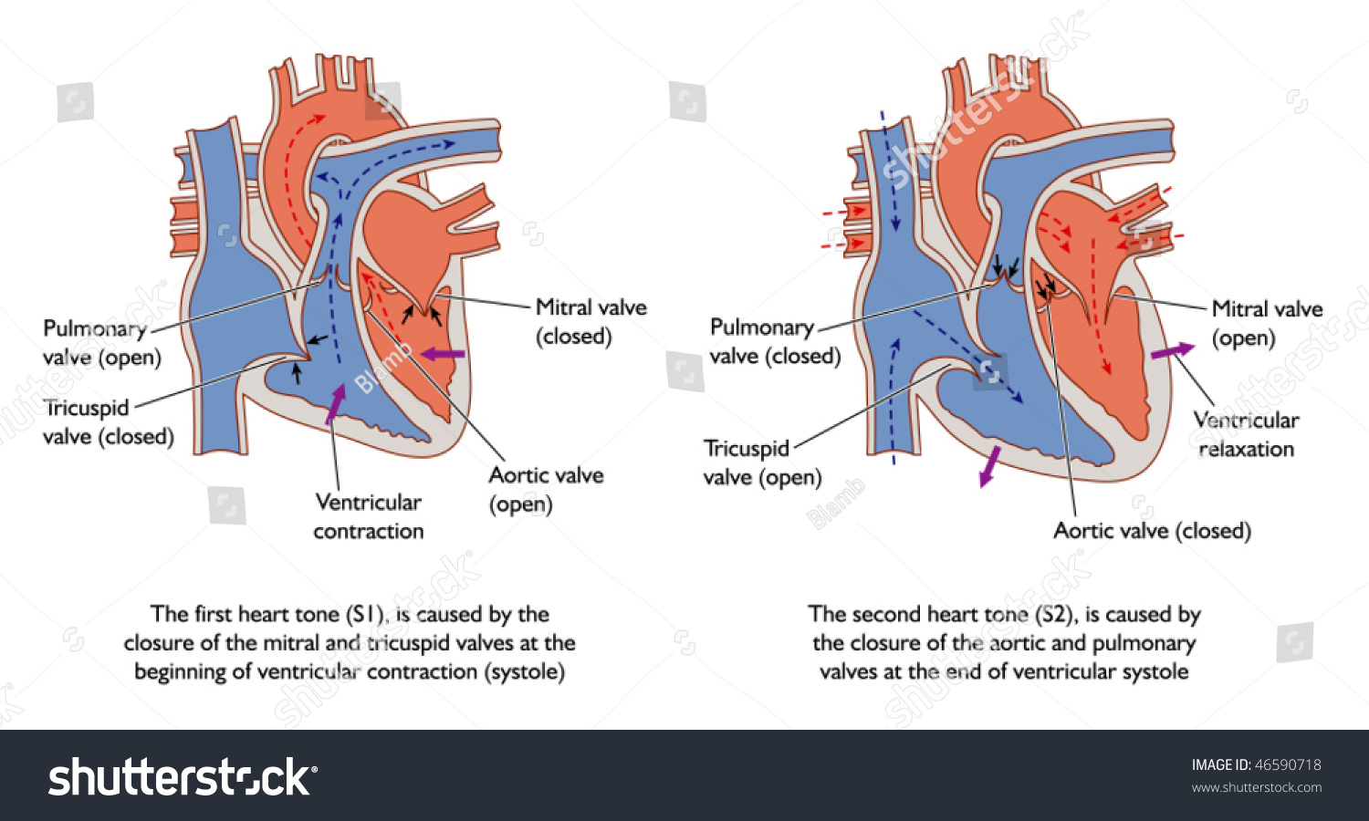 S1s2 Heart Sounds