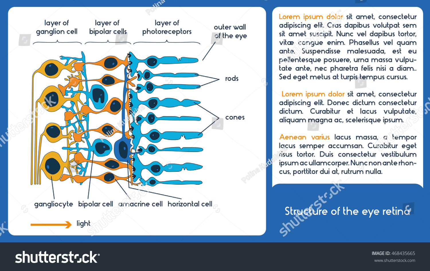 Structure Eye Retina Infographic Scheme Stock Vector (Royalty Free ...