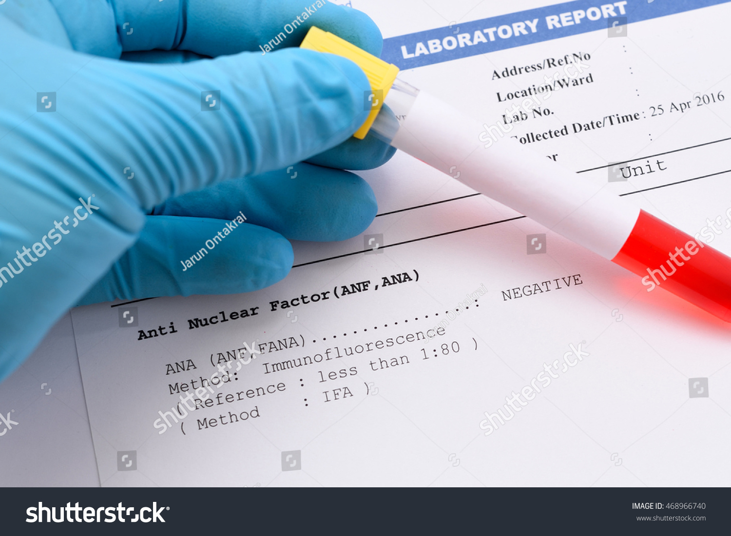 Blood Sample Antinuclear Factor Anf Testing Stock Photo 468966740 ...