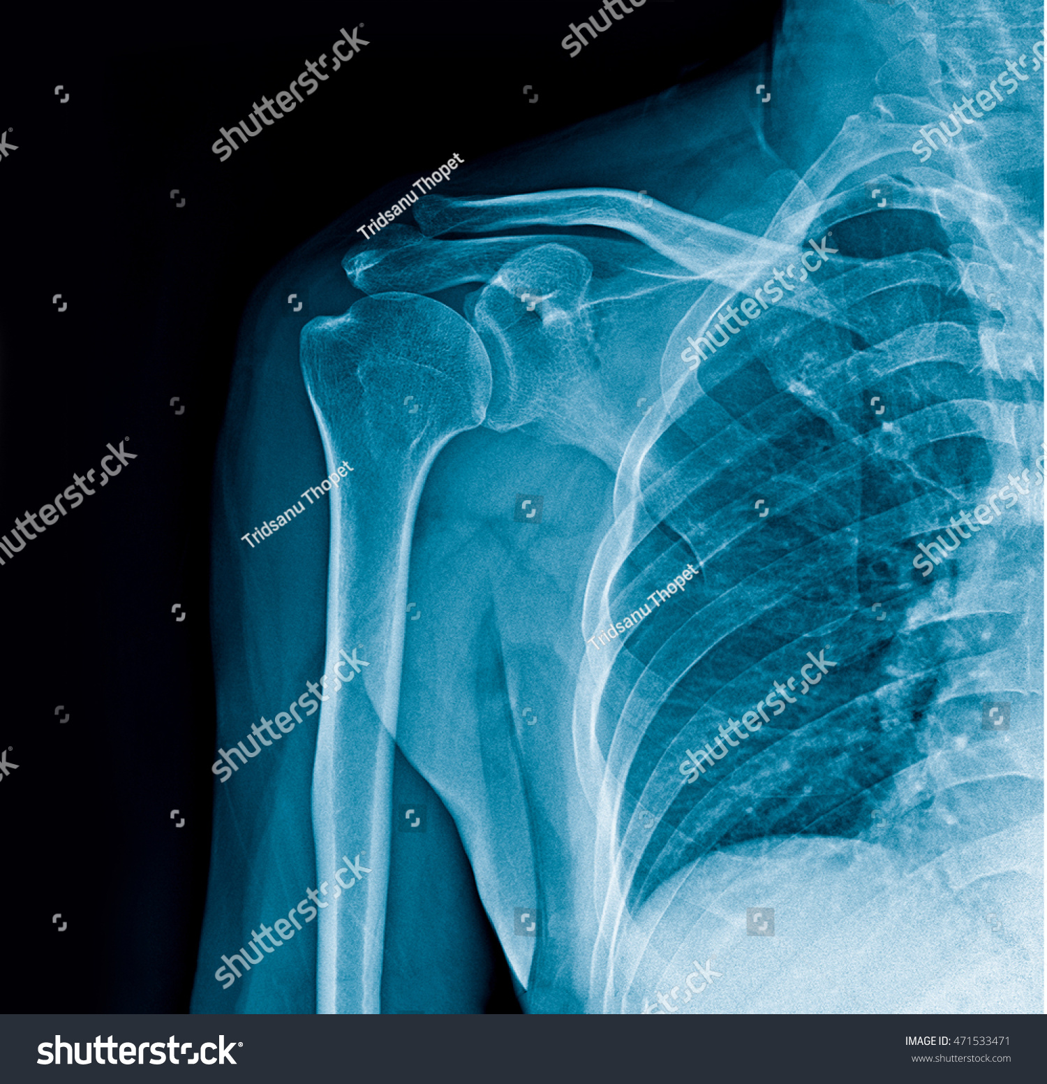 human shoulder bone structure