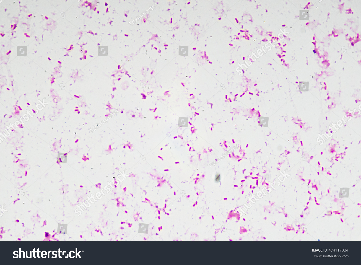 Gram Negative Bacilli Bacteria Microbiology Stock Photo 474117334 ...