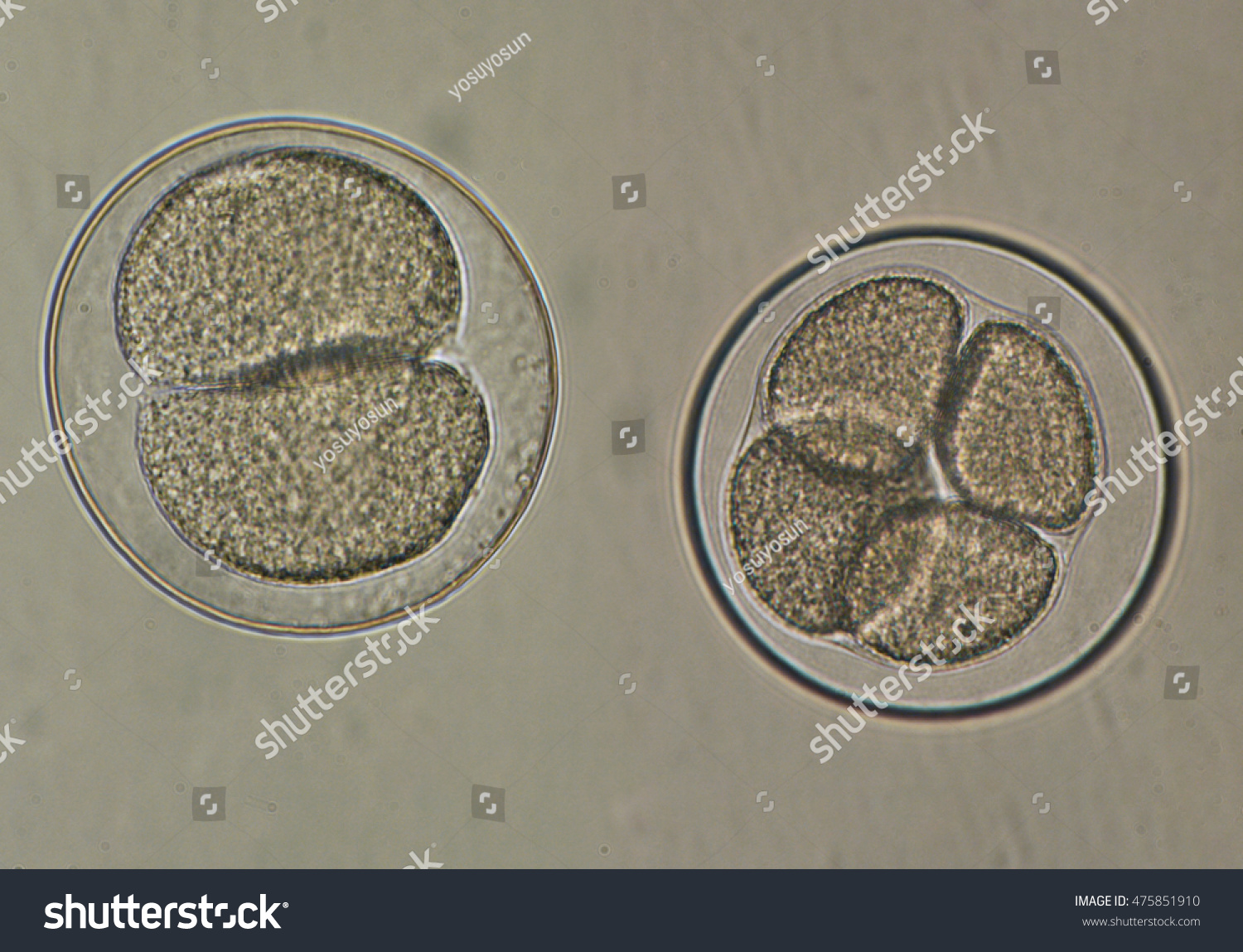 Sea Urchin Embryo Cell Division Stock Photo 475851910 Shutterstock